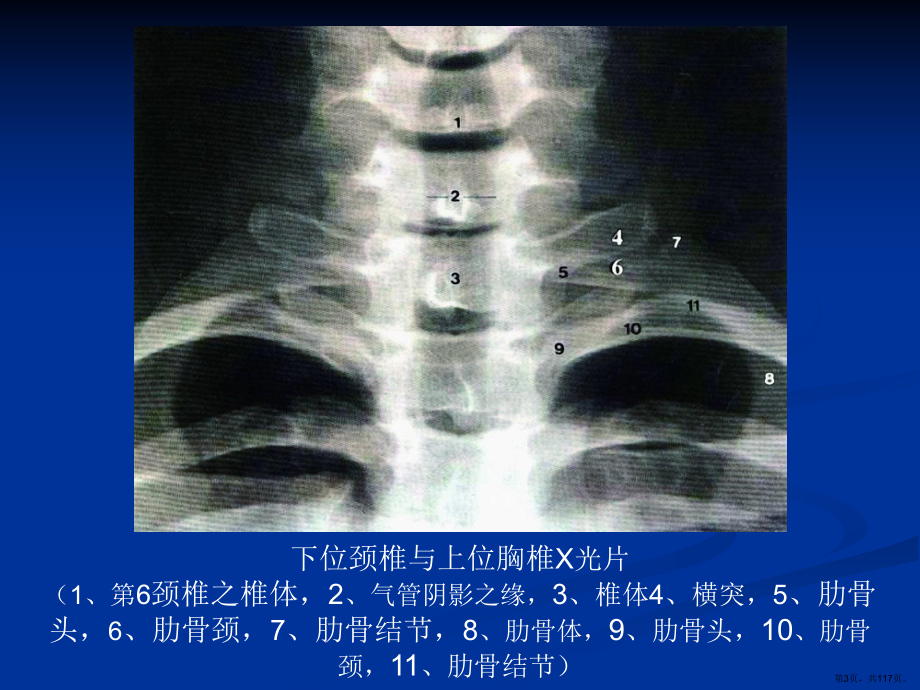 整脊影像学诊断课件(PPT 117页).pptx_第3页