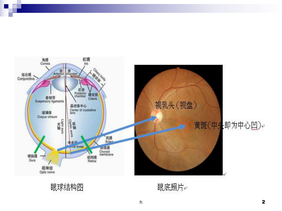 《视网膜病》PPT课件.ppt_第2页