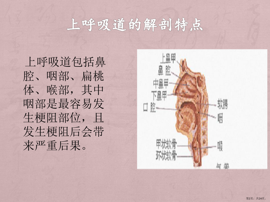 口咽通气管的使用课件(PPT 24页).pptx_第2页