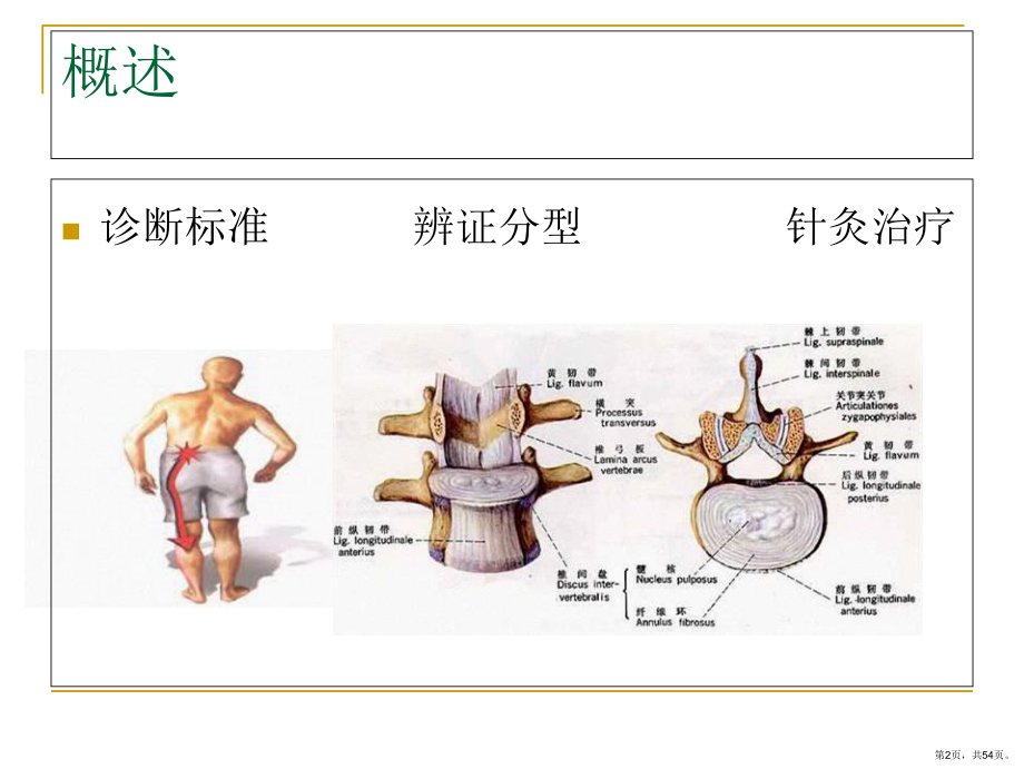 腰椎间盘突出症针灸治疗课件(PPT 54页).pptx_第2页