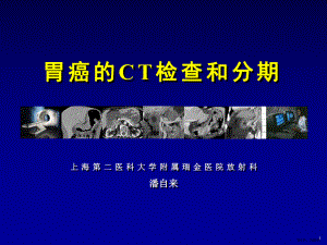 胃癌的CT检查和分期课件(PPT 90页).pptx