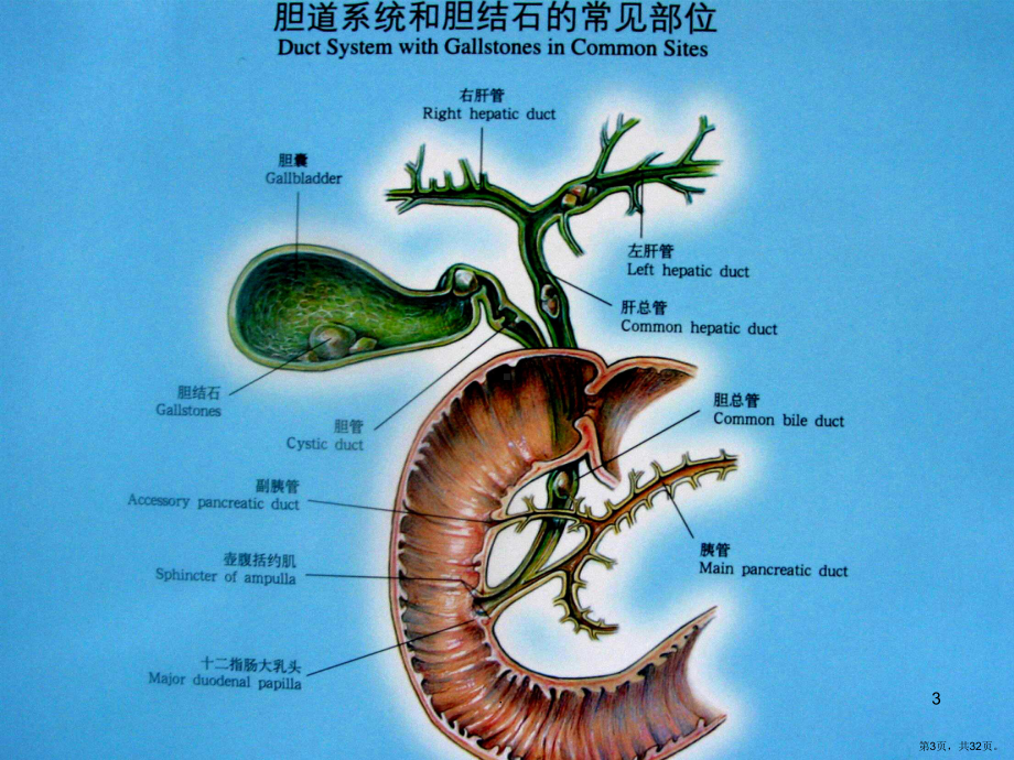 胆总管切开取石T管引流术分享PPT医学课件(PPT 32页).pptx_第3页