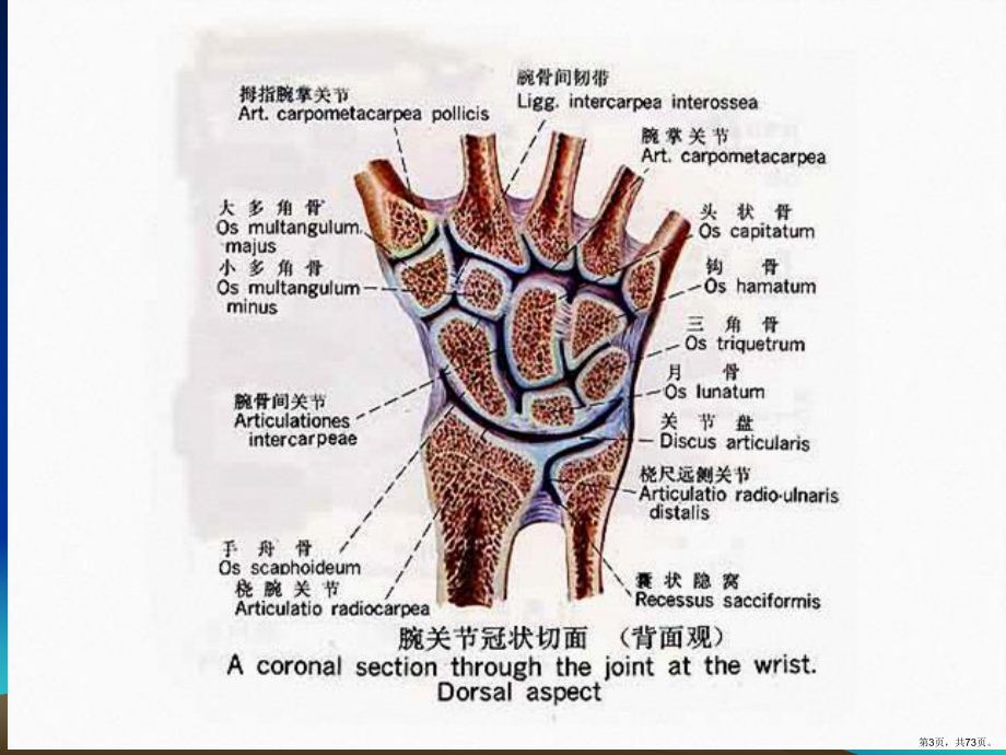 腕关节MR-ppt课件(PPT 73页).pptx_第3页