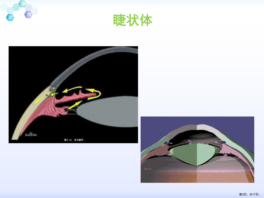 睫状体冷冻术课件(PPT 17页).pptx_第3页