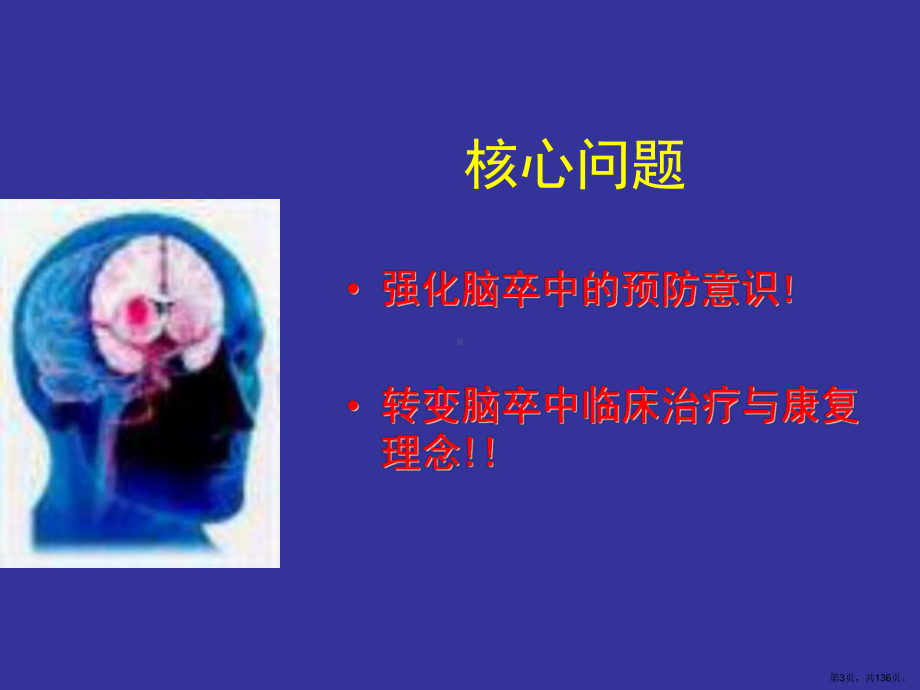 脑卒中的防治与康复课件(PPT 136页).pptx_第3页