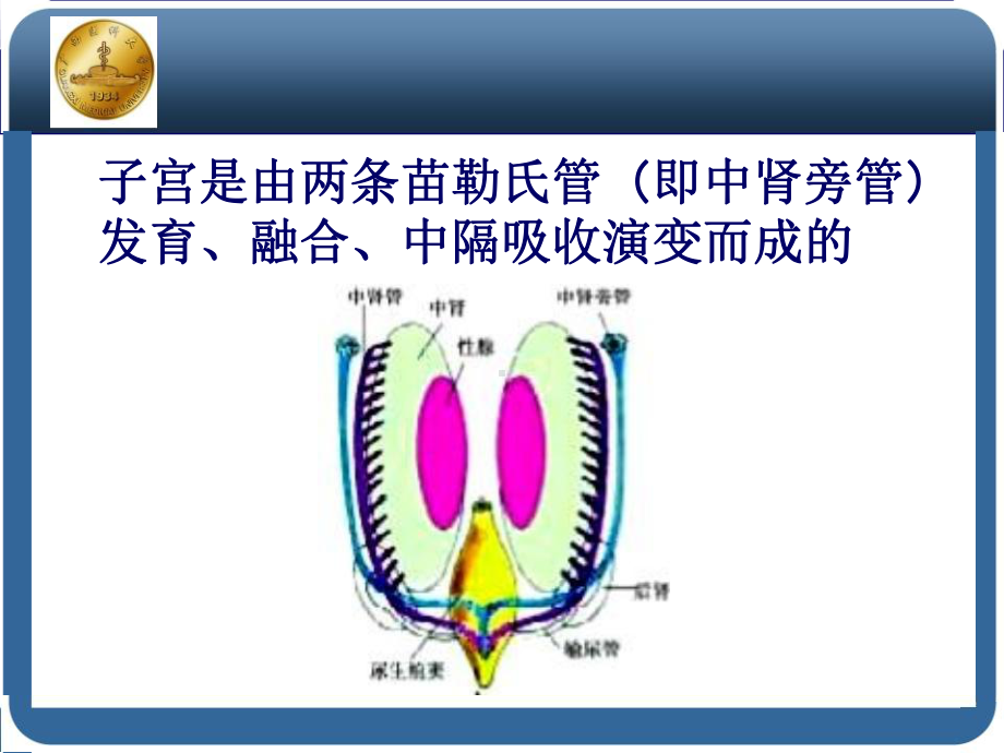 先天性子宫畸形PPT课件.pptx_第3页