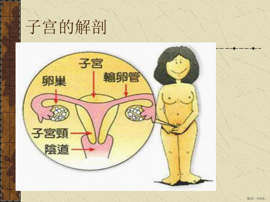 腹腔镜下子宫全切的术中配合及护理课件(PPT 23页).pptx_第2页