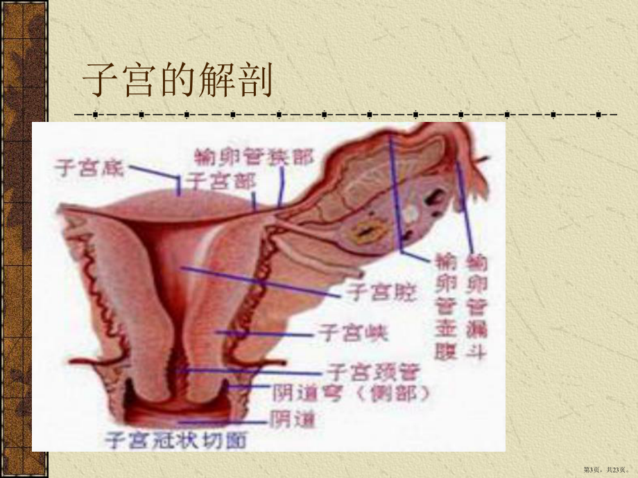 腹腔镜下子宫全切的术中配合及护理课件(PPT 23页).pptx_第3页