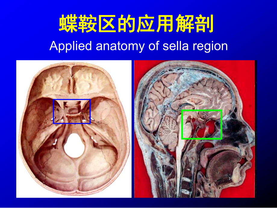 蝶鞍区断层解剖与影像对照PPT医学课件(PPT 76页).pptx_第1页