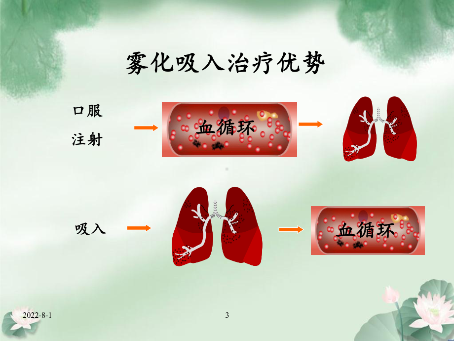 儿童常见呼吸道疾病雾化吸入药学服务课件.ppt_第3页