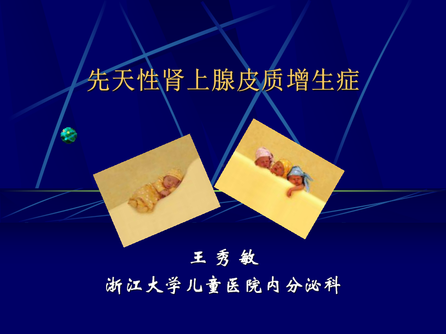 儿童时期糖尿病课件.ppt_第1页