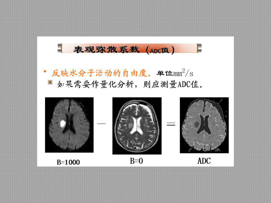 全身类PET肿瘤筛查-磁共振的DWI的参数-44页PPT课件.ppt_第2页