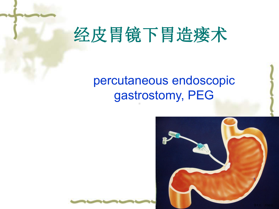 经皮胃镜下胃造瘘PPT演示课件(PPT 50页).pptx_第1页