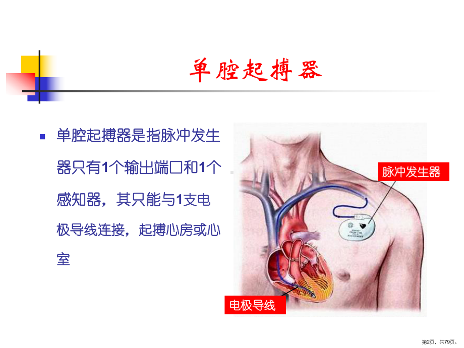 起搏心电图阅读与分析-许原课件(PPT 79页).pptx_第2页