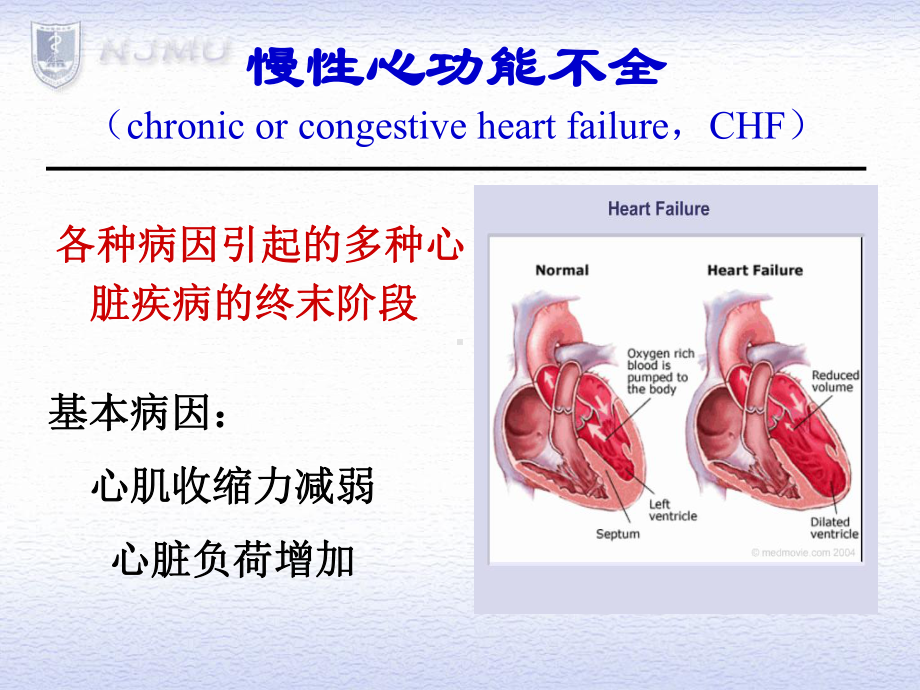 充血性心力衰竭课件.ppt_第2页