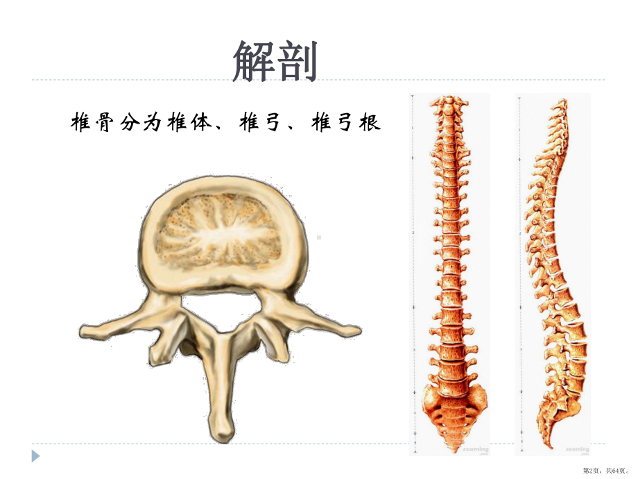 腰椎骨折患者的护理课件(PPT 64页).pptx_第2页