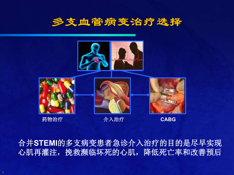 合并多支血管病变STEMI介入治疗策略课件.ppt_第2页