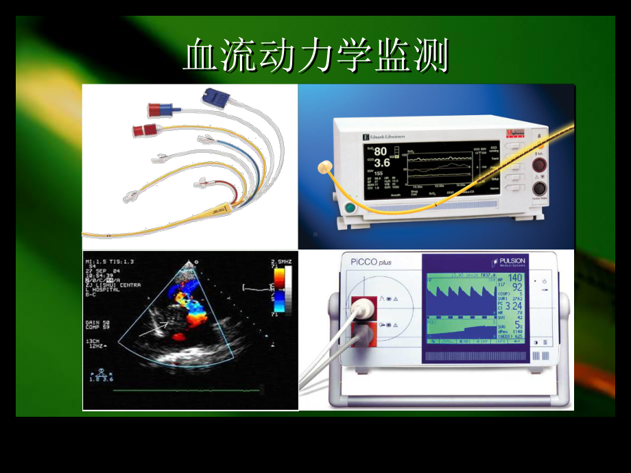 危重病患者的血流动力学监测与治疗课件.ppt_第3页