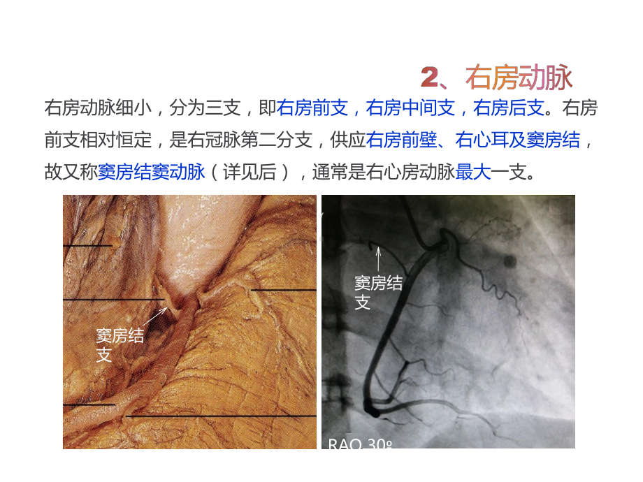 冠状动脉解剖与冠状动脉造影课件2.pptx_第1页