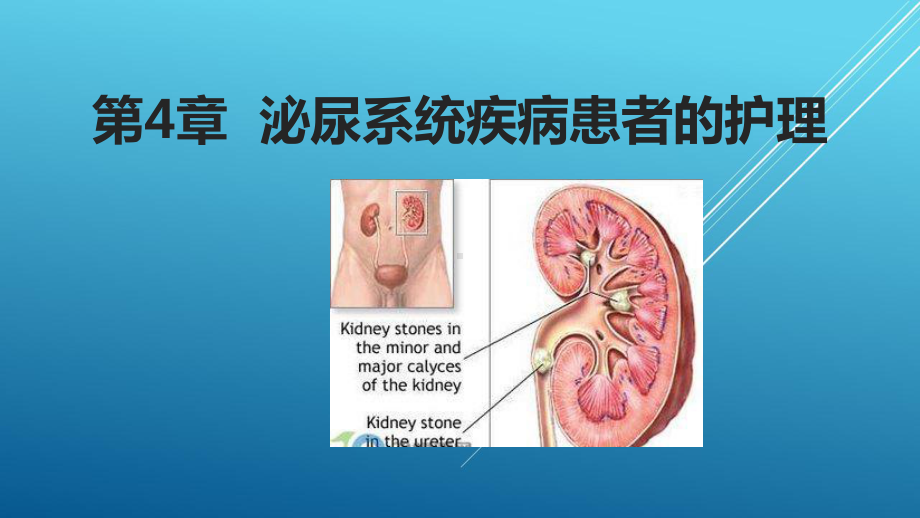 内科护理学第四章-89课件.pptx_第1页