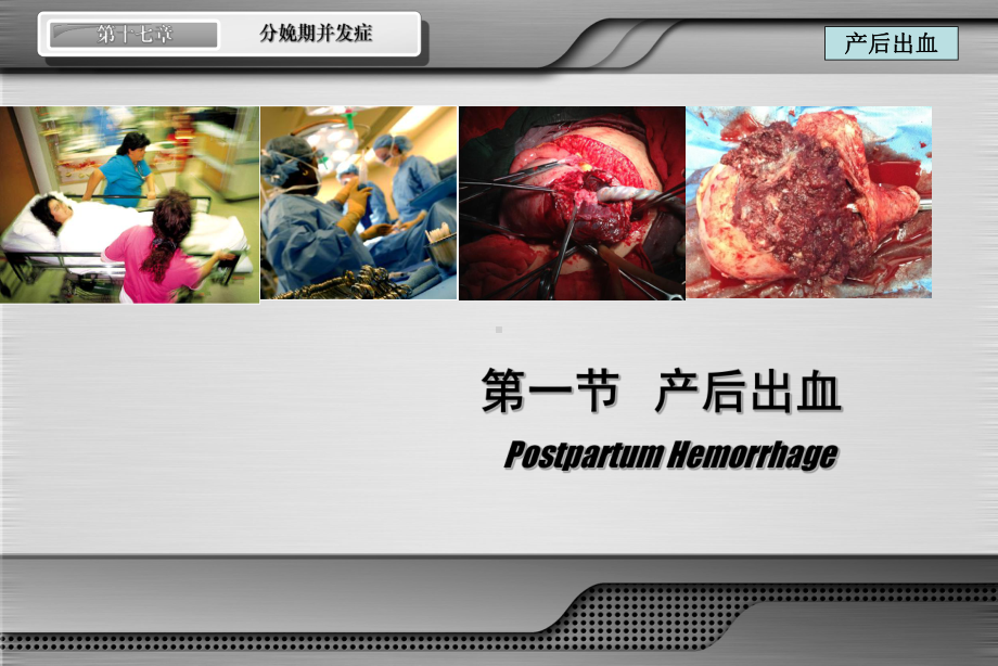 分娩期并发症ppt课件.ppt_第2页