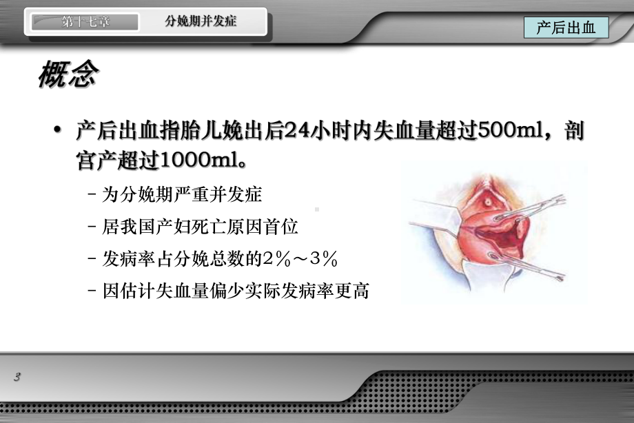 分娩期并发症ppt课件.ppt_第3页