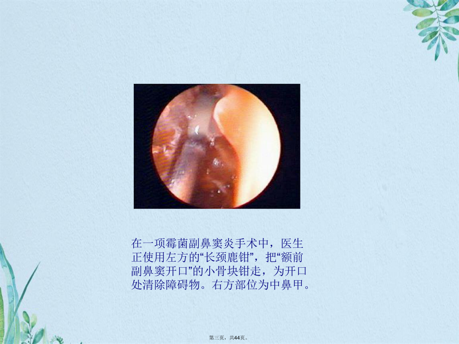 内窥镜成像(共44张PPT)课件.pptx_第3页