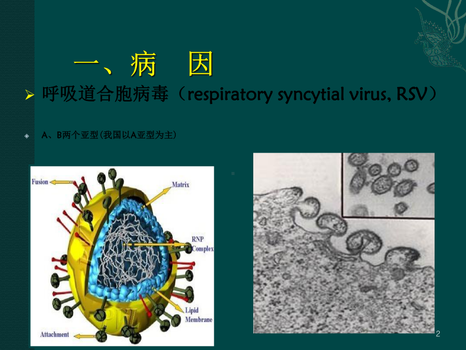 呼吸道合孢病毒肺炎及研究新进展课件.ppt_第2页