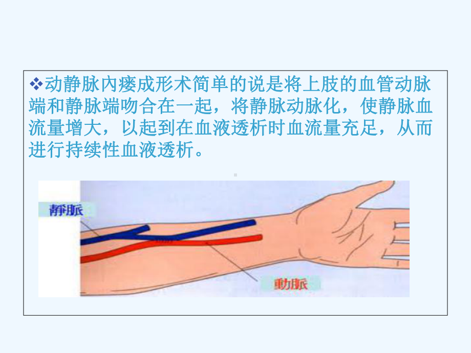 动静脉内瘘护理查房课件.ppt_第2页