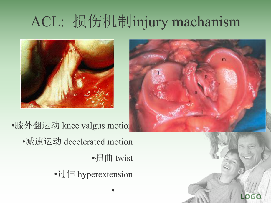 前交叉流程优化课件.ppt_第2页