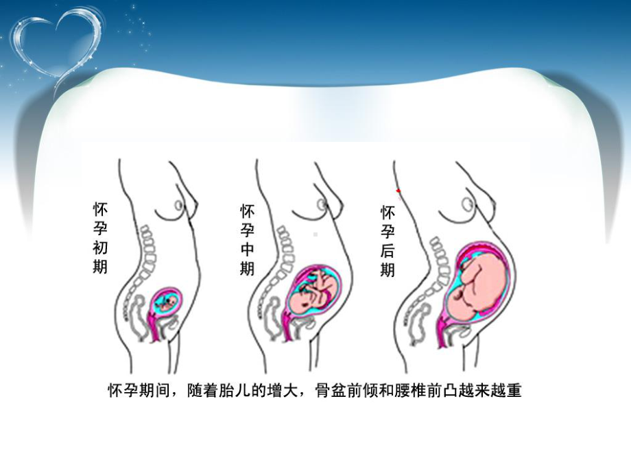 关爱女性盆底健康-盆底康复课件.ppt_第3页