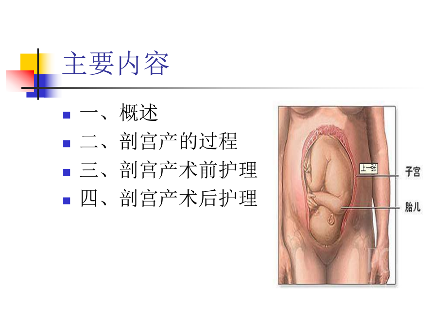 剖宫产护理常规课件.ppt_第2页