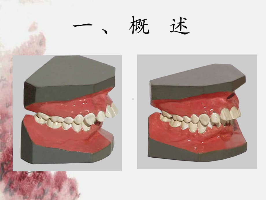 前牙深覆盖解析课件.ppt_第2页