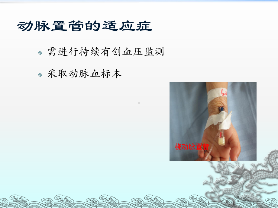 动静脉置管讲解课件.ppt_第3页