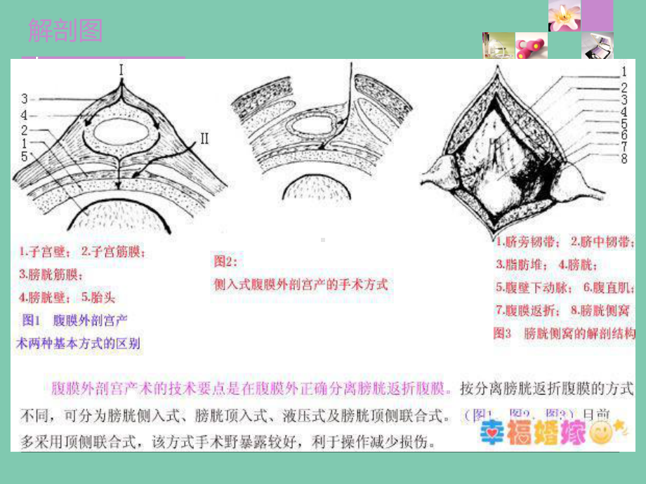 剖宫产切口愈合不良的护理-22页PPT课件.ppt_第3页