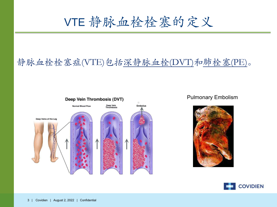 医院血栓预防介绍-血栓TED课件.ppt_第3页