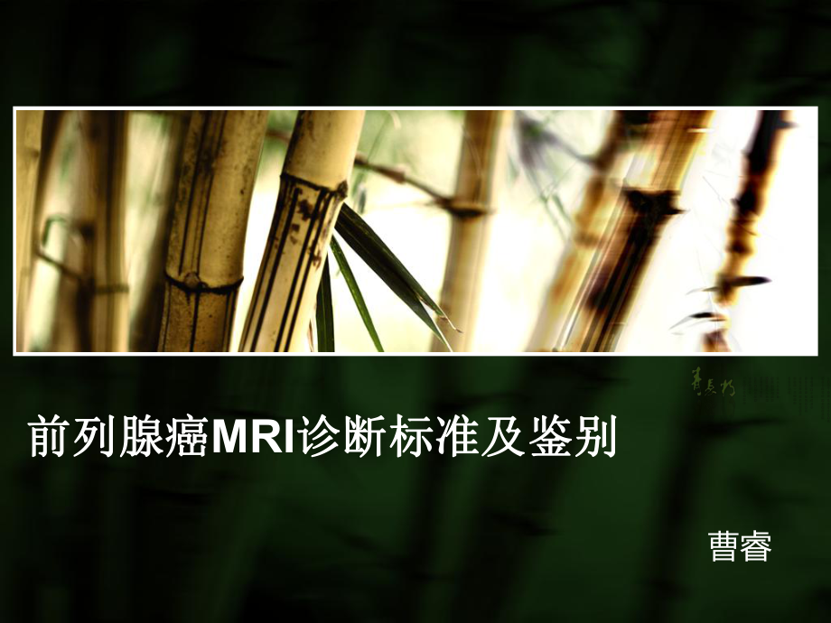 前列腺癌mri分期及鉴别诊断课件.ppt_第2页