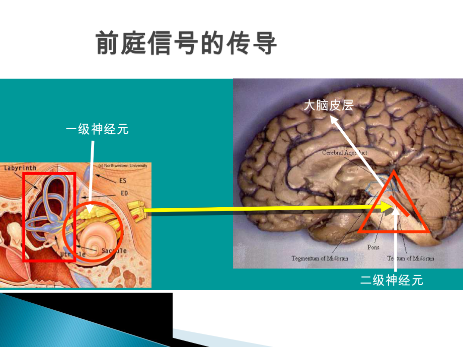 前庭代偿(ppt)课件.ppt_第3页