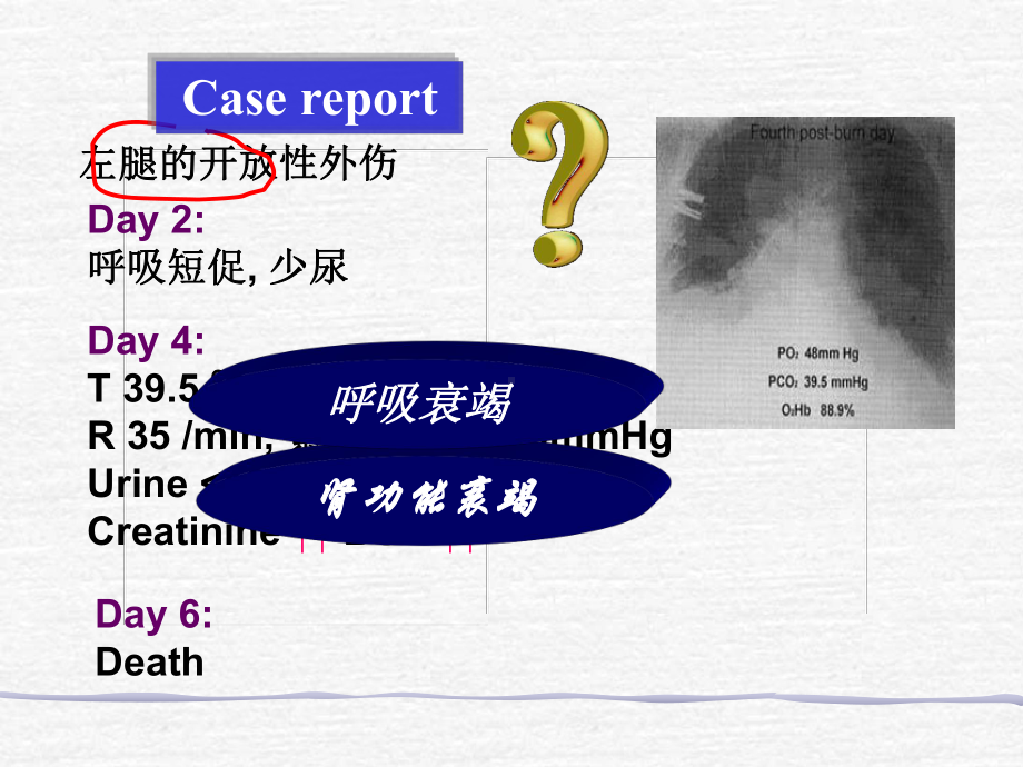 多器官功能障碍综合症MODS课件.ppt_第2页