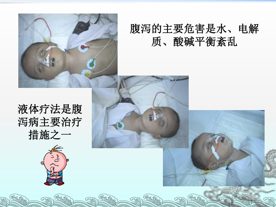 小儿腹泻液体疗法(医学PPT课件).ppt_第2页