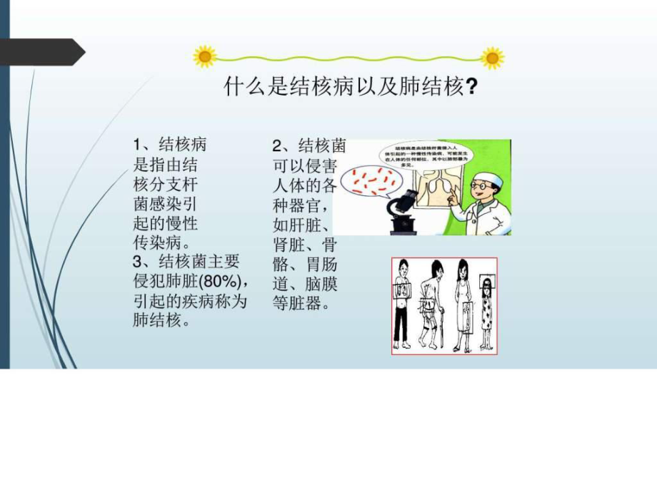 学生结核病防治知识宣传(中学)-图文.ppt课件.ppt_第3页