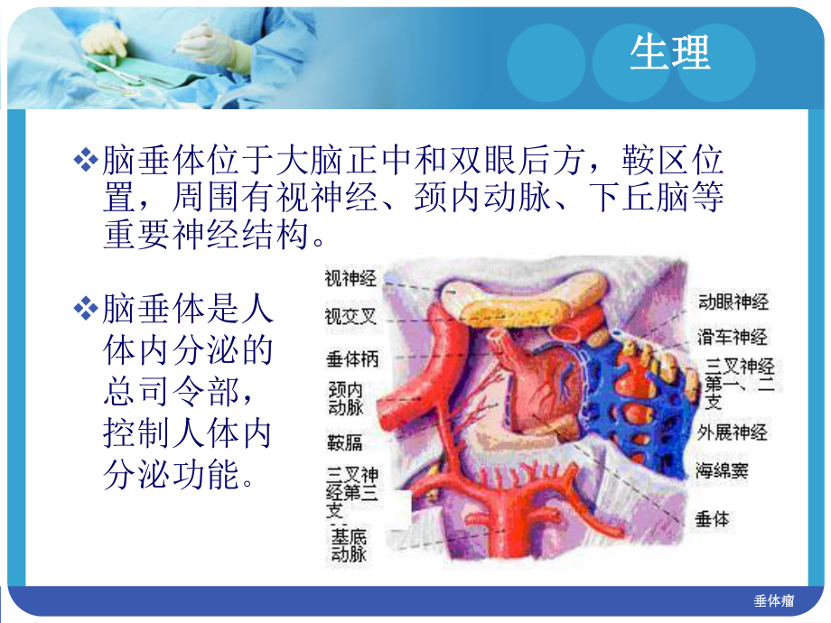 垂体瘤护理查房47916课件.ppt_第3页