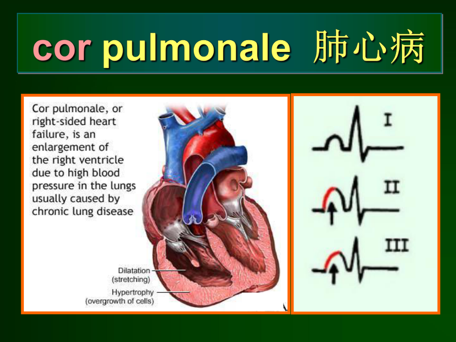 图解医学术语-心血管系统ppt课件.ppt_第3页