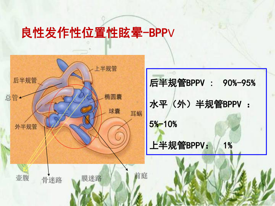 常见类耳石症的手法复位-图文课件.pptx_第3页