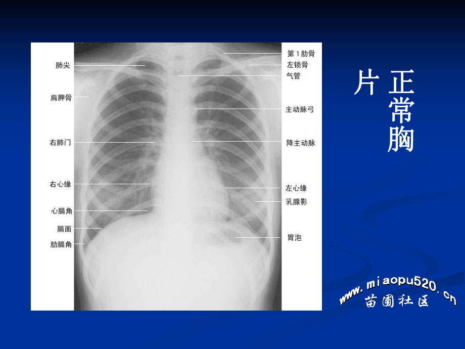 年执业医师技能考试-X线课件.ppt_第2页