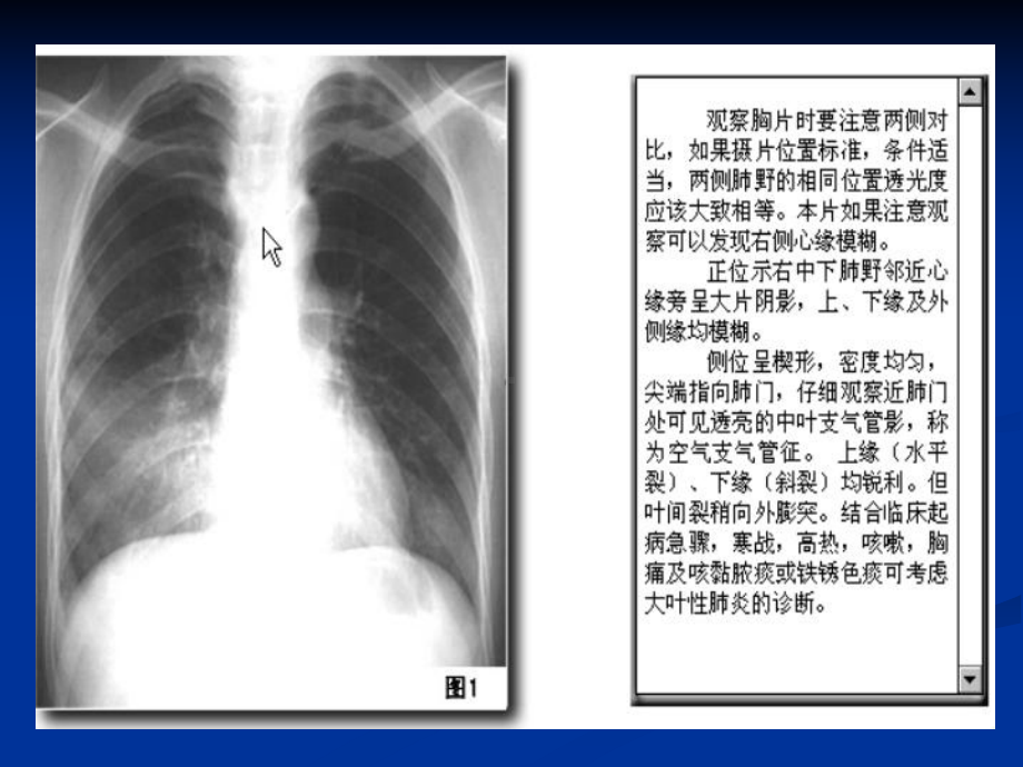 年执业医师技能考试-X线课件.ppt_第3页