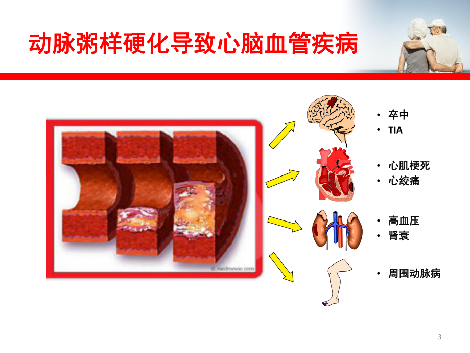 控制血脂与防范心脑血管疾病课件.ppt_第3页