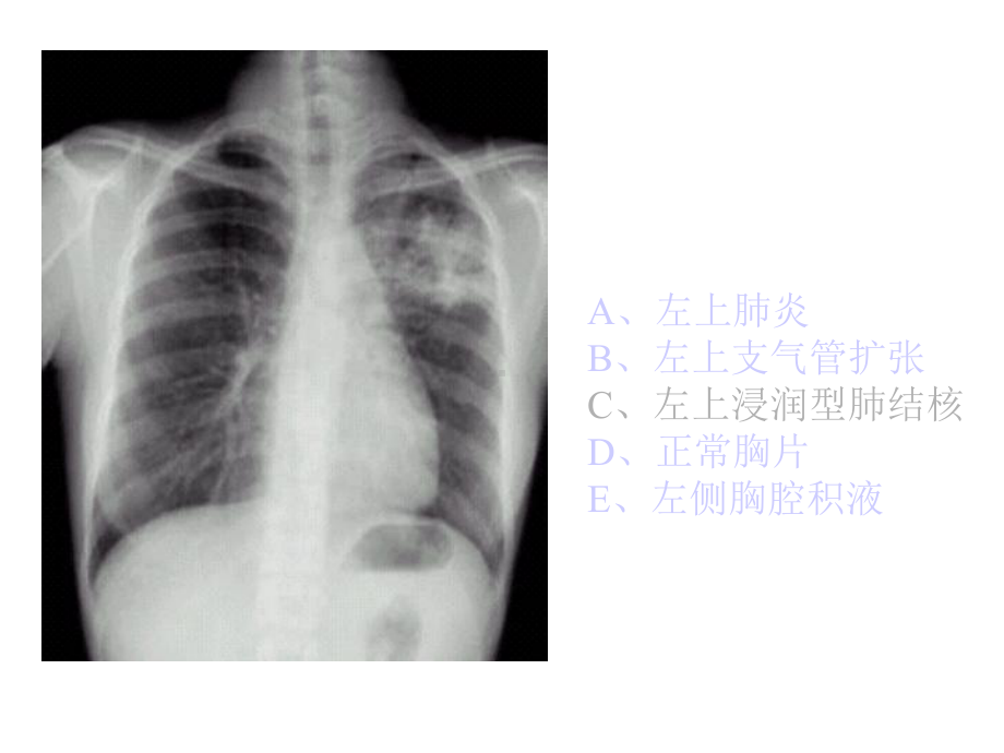 执业医师操作考试(X光片)课件.ppt_第2页