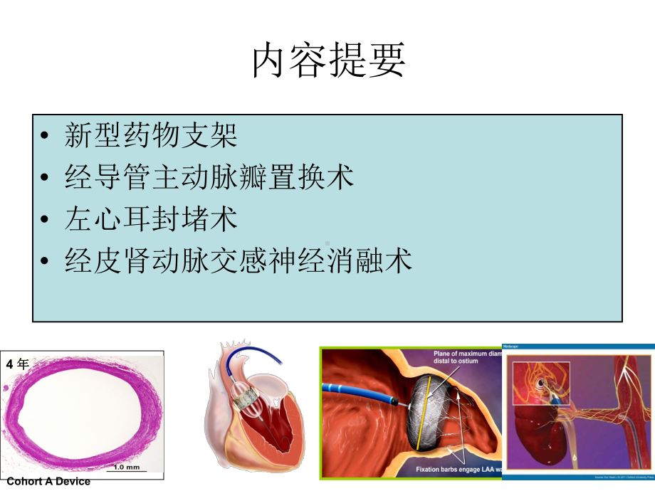 心血管介入治疗技术课件.ppt_第2页