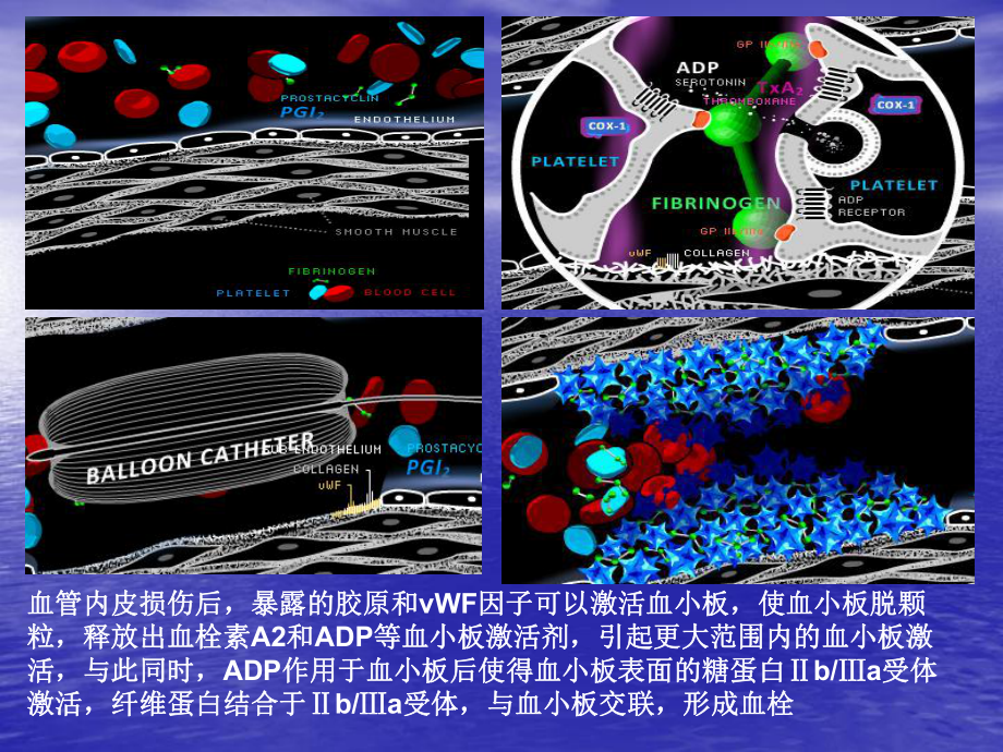 抗血小板治疗课件.ppt_第2页